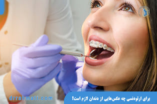 برای ارتودنسی چه عکس‌هایی از دندان لازم است؟