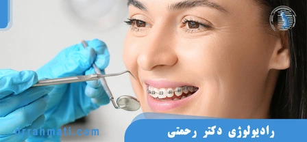 بهترین سن برای انجام ارتودنسی چه زمانی است؟